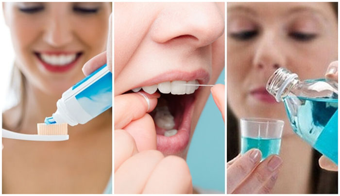 Vệ sinh răng miệng sạch sẽ để loại bỏ mảng bám, vi khuẩn có hại