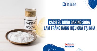 Cách sử dụng baking soda làm trắng răng hiệu quả tại nhà