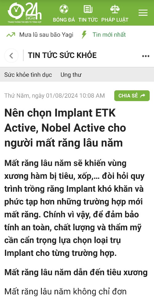 Nên chọn implant loại nào