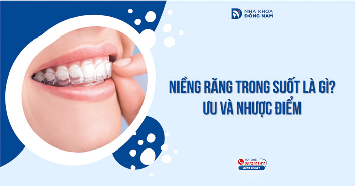 Niềng răng trong suốt là gì? Ưu và nhược điểm