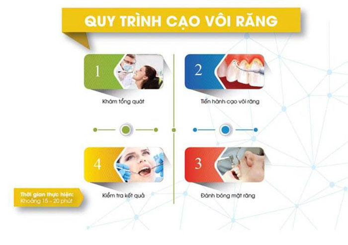 Quy trình cạo vôi răng tại Nha khoa Đông Nam