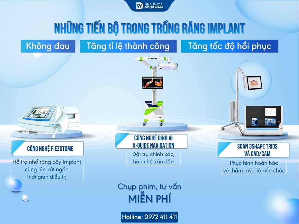 Nha khoa đầu tư trang thiết bị máy móc hiện đại