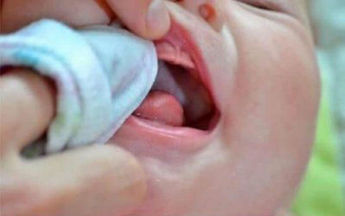 Nên rửa tay thật sạch trước khi tiến hành rơ lưỡi cho trẻ sơ sinh