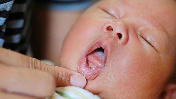 Rơ lưỡi cho trẻ sơ sinh rất quan trọng trong việc phòng ngừa bệnh lý từ sớm