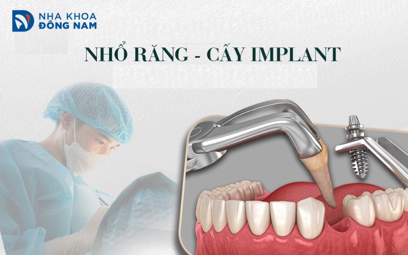 Nha khoa Đông Nam cam kết mang lại cho khách hàng những trải nghiệm tốt nhất