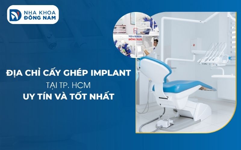 trồng răng implant tại tphcm