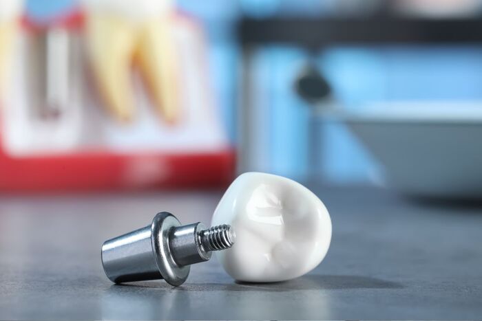 Healing Abutment (trụ lành thương) hay còn gọi là Healing Implant