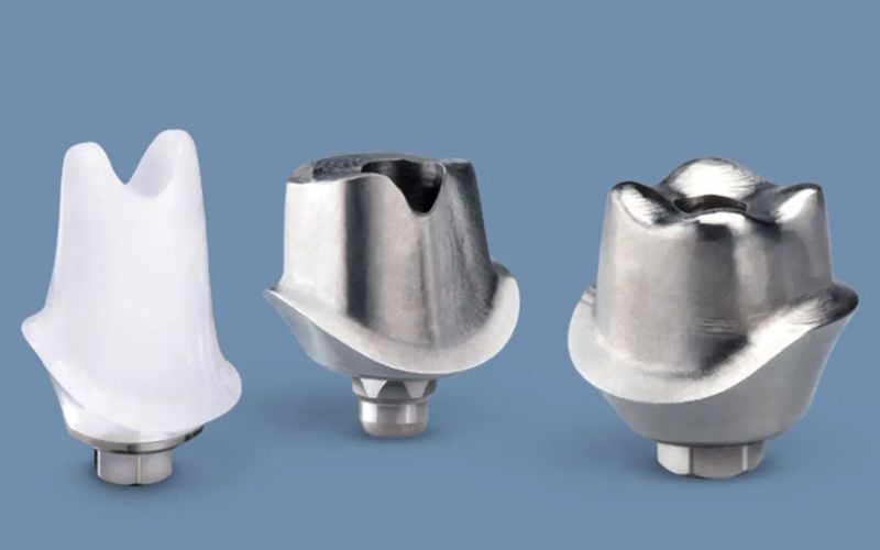 Abutment cá nhân hóa giúp hạn chế tối đa tình trạng dính giắt thức ăn