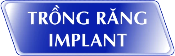 bảng giá trồng răng implant