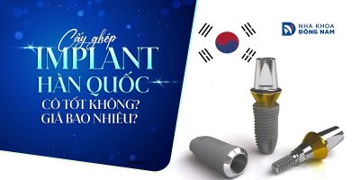 Cấy ghép Implant Hàn Quốc có tốt không? Giá bao nhiêu?