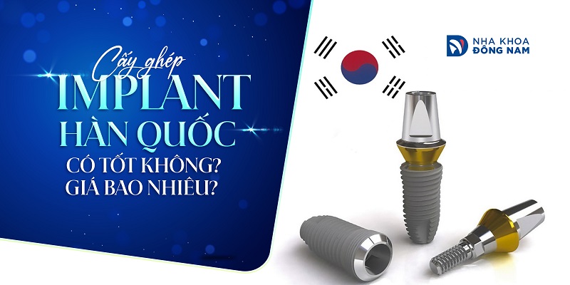 Cấy ghép Implant Hàn Quốc có tốt không? Giá bao nhiêu?