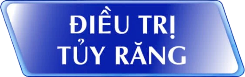 bảng giá chữa tủy răng