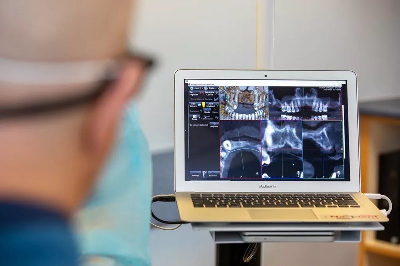 Dữ liệu từ phim CT Cone Beam 3D được tích hợp vào phần mềm giúp lên kế hoạch điều trị chi tiết