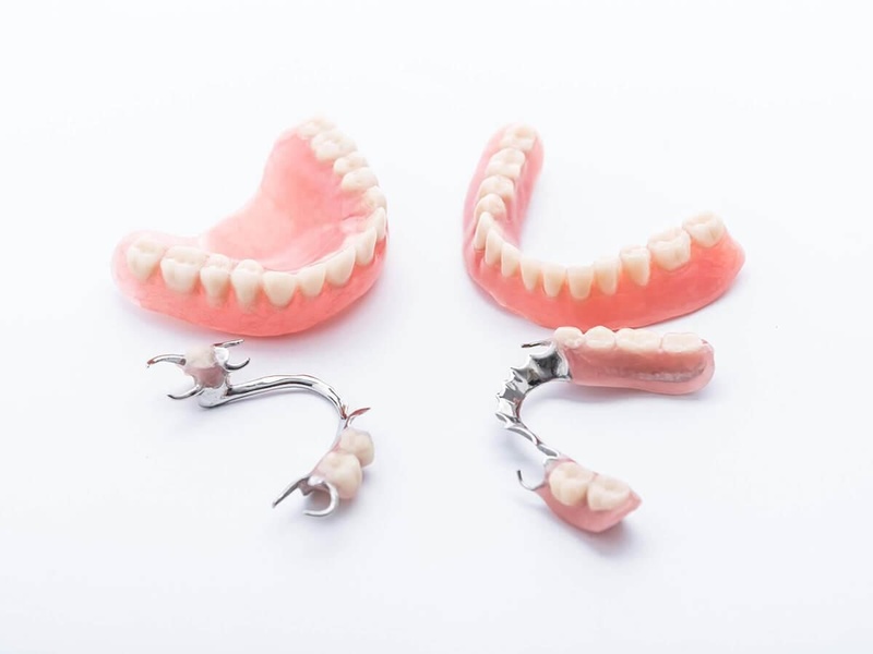Hàm giả tháo lắp phục hình truyền thống