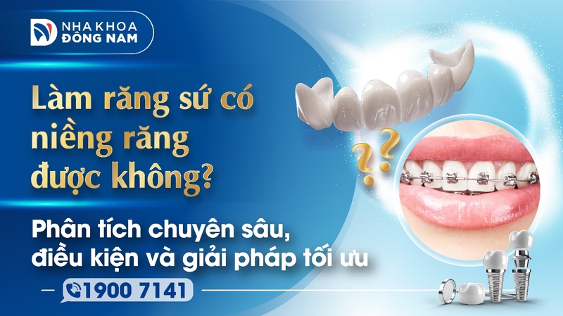 Làm răng sứ có niềng răng được không? Phân tích chuyên sâu, điều kiện và giải pháp tối ưu