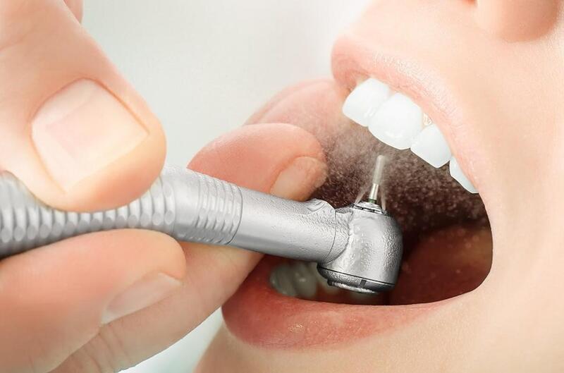 Mài răng bọc sứ không phải là phương pháp lý tưởng cho mọi trường hợp