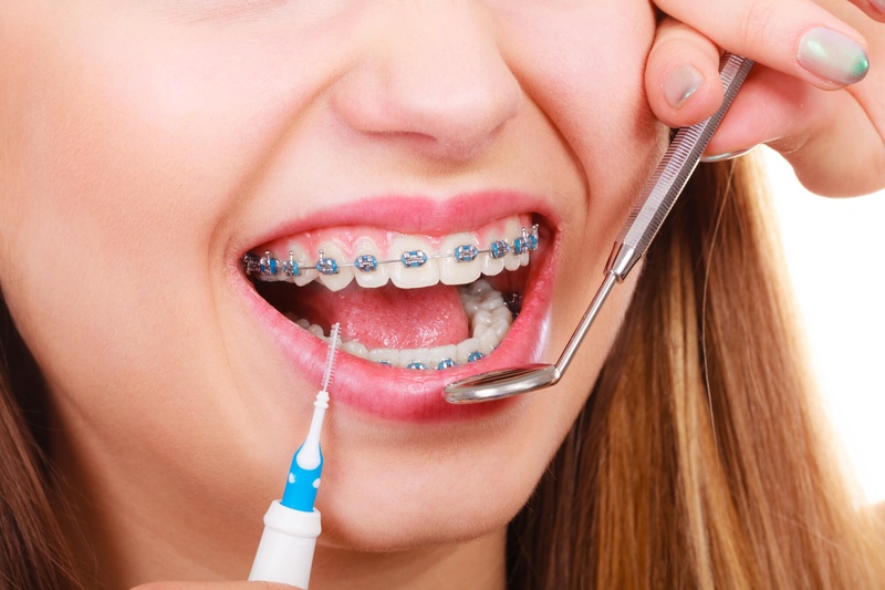 Mão răng sứ cần được chế tác đúng tiêu chuẩn