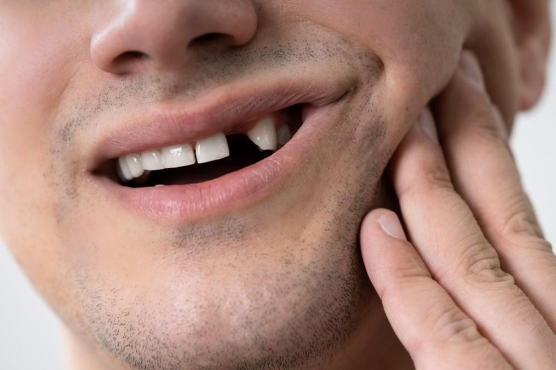 Mất răng ảnh hưởng trực tiếp đến thẩm mỹ và tâm lý