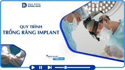 Quy trình trồng răng Implant