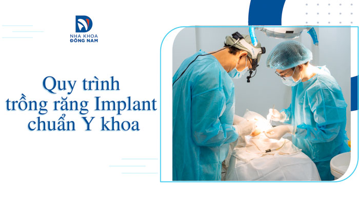 Quy trình trồng răng Implant