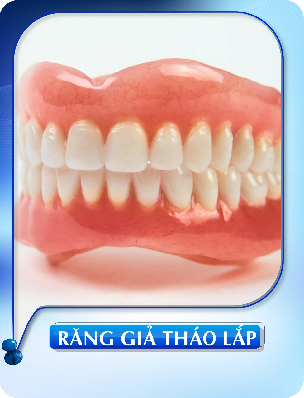 Răng giả tháo lắp