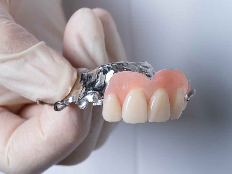 Răng giả tháo lắp thay thế khi răng mất