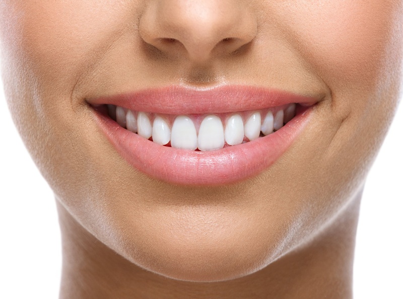 Răng thỏ mọc đều đẹp, trắng sáng đem lại nụ cười duyên dáng