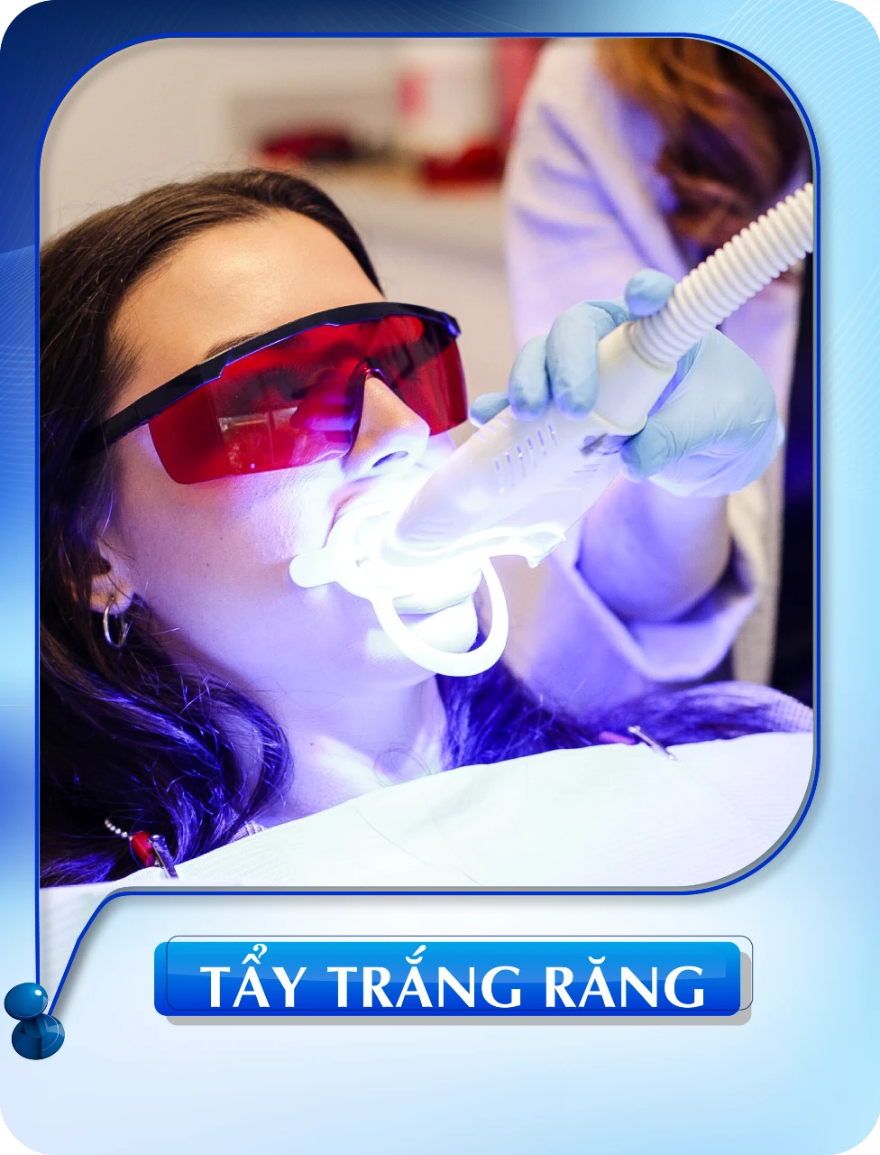Tẩy trắng răng