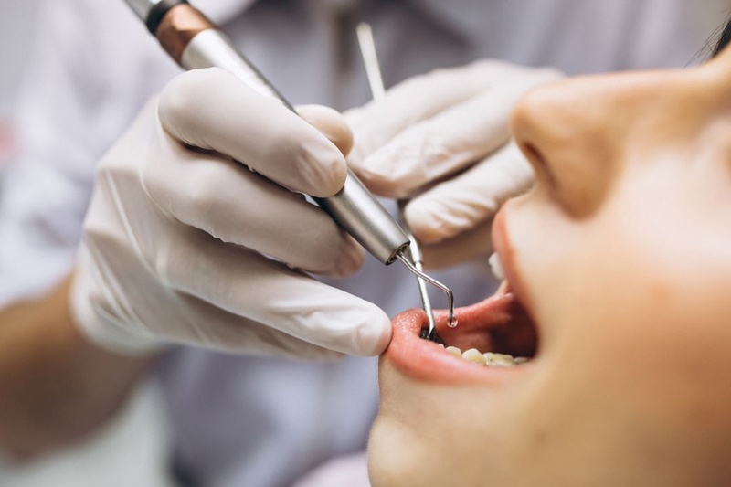 Thăm khám kiểm tra răng miệng định kỳ