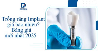 Trồng răng Implant giá bao nhiêu?