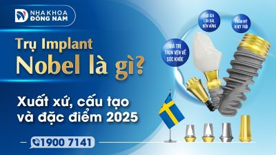 Trụ Implant Nobel là gì? Xuất xứ, đặc điểm và cấu tạo 2025