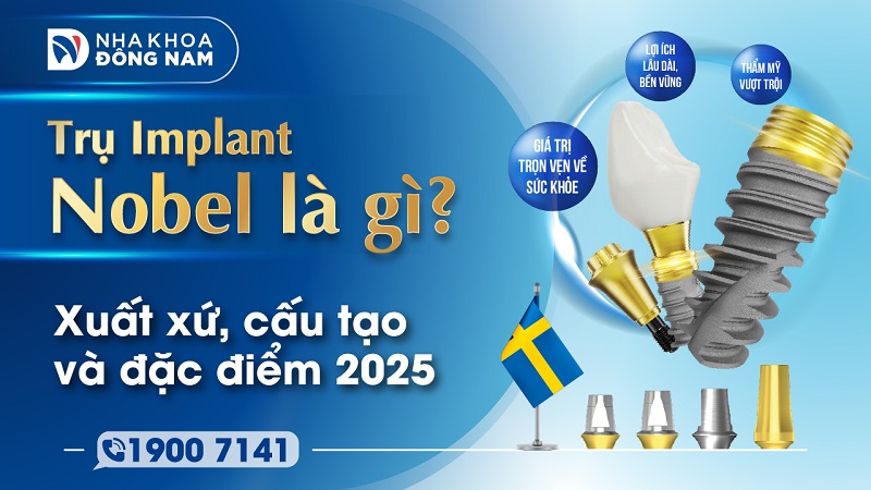 Trụ Implant Nobel là gì? Xuất xứ, đặc điểm và cấu tạo 2025