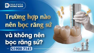 Trường hợp nào nên bọc răng sứ và không nên bọc răng sứ?