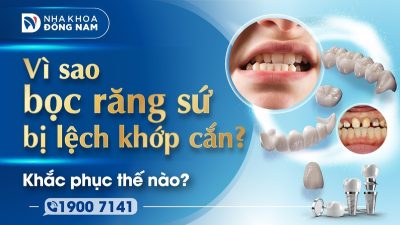 Vì sao bọc răng sứ bị lệch khớp cắn? Khắc phục thế nào?
