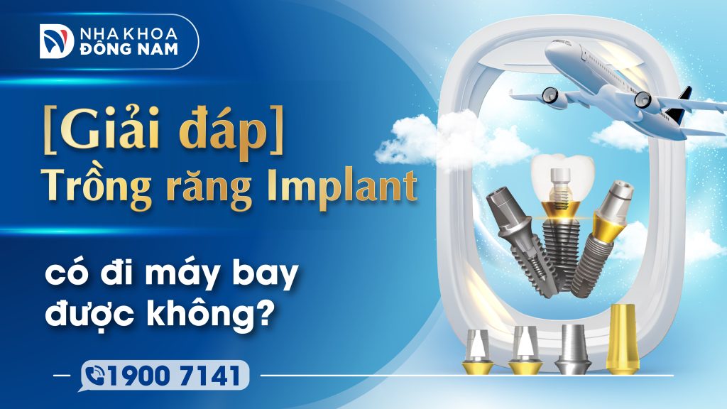 Trồng răng Implant có đi máy bay được không?