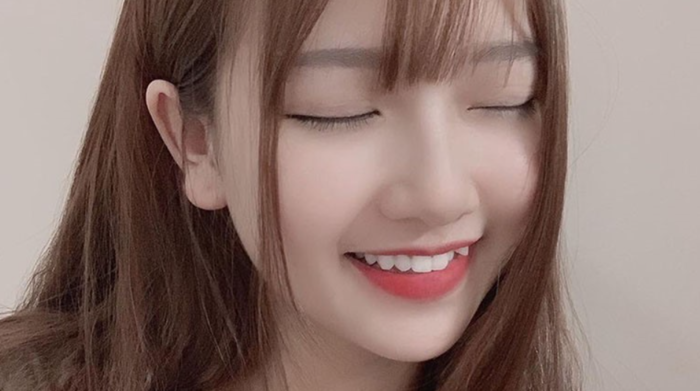 Răng khểnh có bọc sứ được không