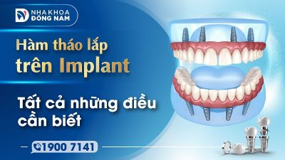 Hàm tháo lắp trên Implant