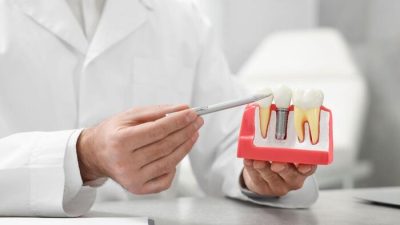 mất răng lâu năm trồng implant được không