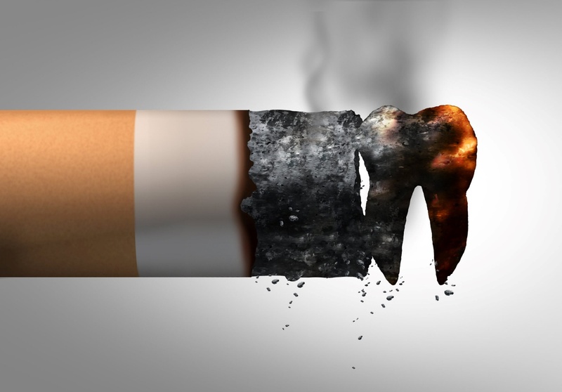 Thuốc lá gây đào thải Implant hàng đầu
