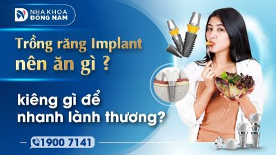 Trồng răng Implant nên ăn gì, kiêng gì để nhanh lành thương