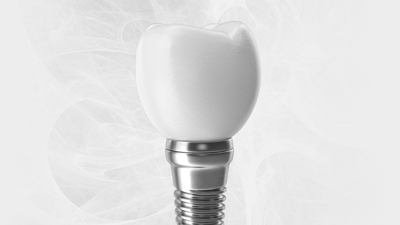 Trụ Implant không bị cảnh báo các thiết bị an ninh sân bay