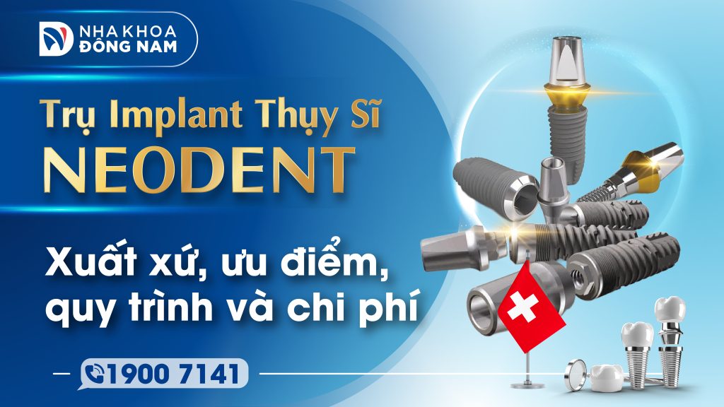 Tìm hiểu toàn diện về xuất xứ, ưu điểm, quy trình và chi phí trụ NEODENT