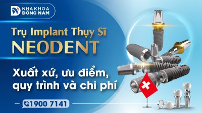 Tìm hiểu toàn diện về xuất xứ, ưu điểm, quy trình và chi phí trụ NEODENT