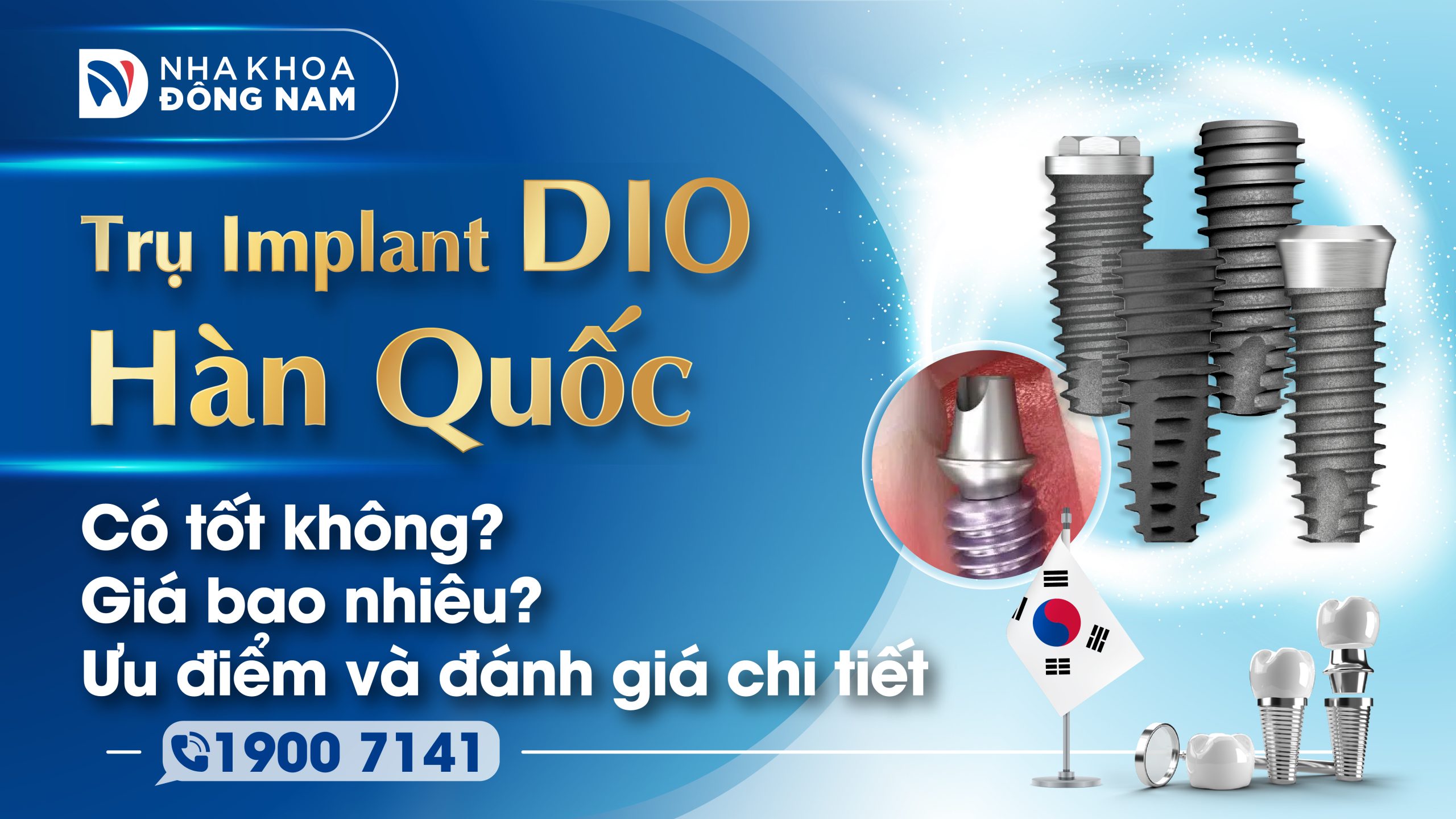 Trụ Implant DIO Hàn Quốc có tốt không? 