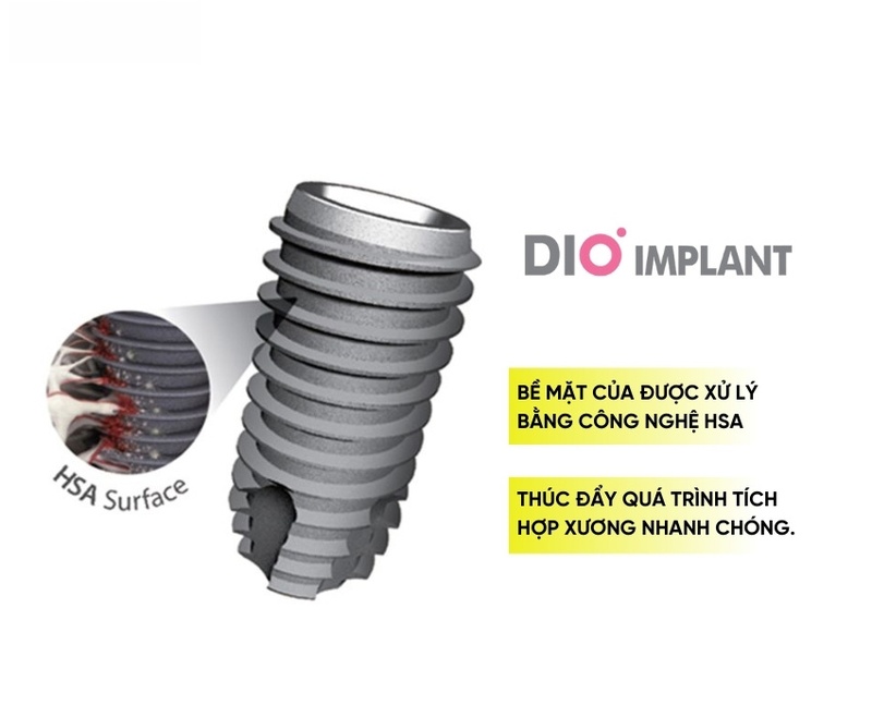 Bề mặt trụ Implant xử lý công nghệ hiện đại