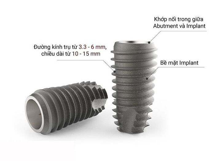 Đặc điểm cấu tạo trụ Implant DiO Hàn Quốc