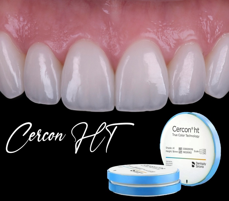 Cercon HT là dòng răng sứ cải tiến từ Cercon truyền thống