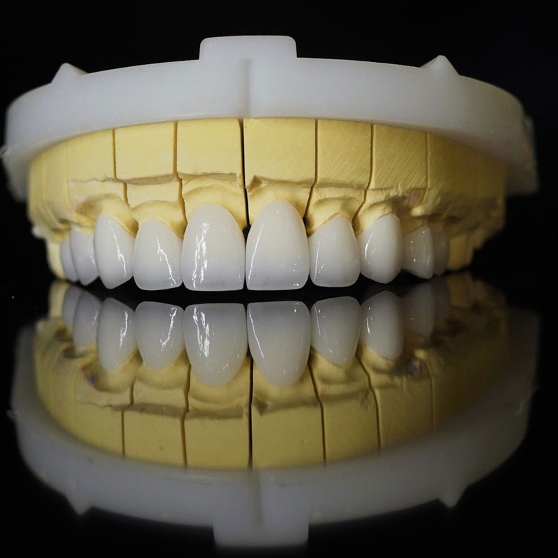 Không chỉ thẩm mỹ mà răng sứ Lava Plus còn đảm bảo chức năng ăn nhai như răng thật