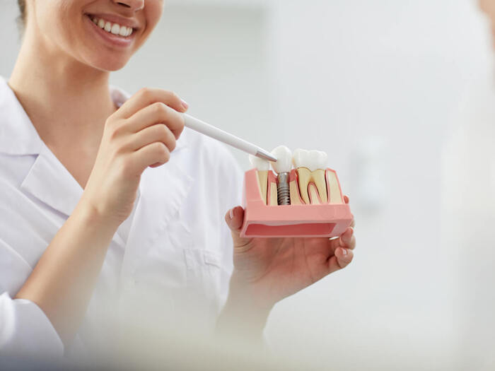 Thời gian lành thương của trụ Implant C-Tech lâu hơn so với các trụ khác