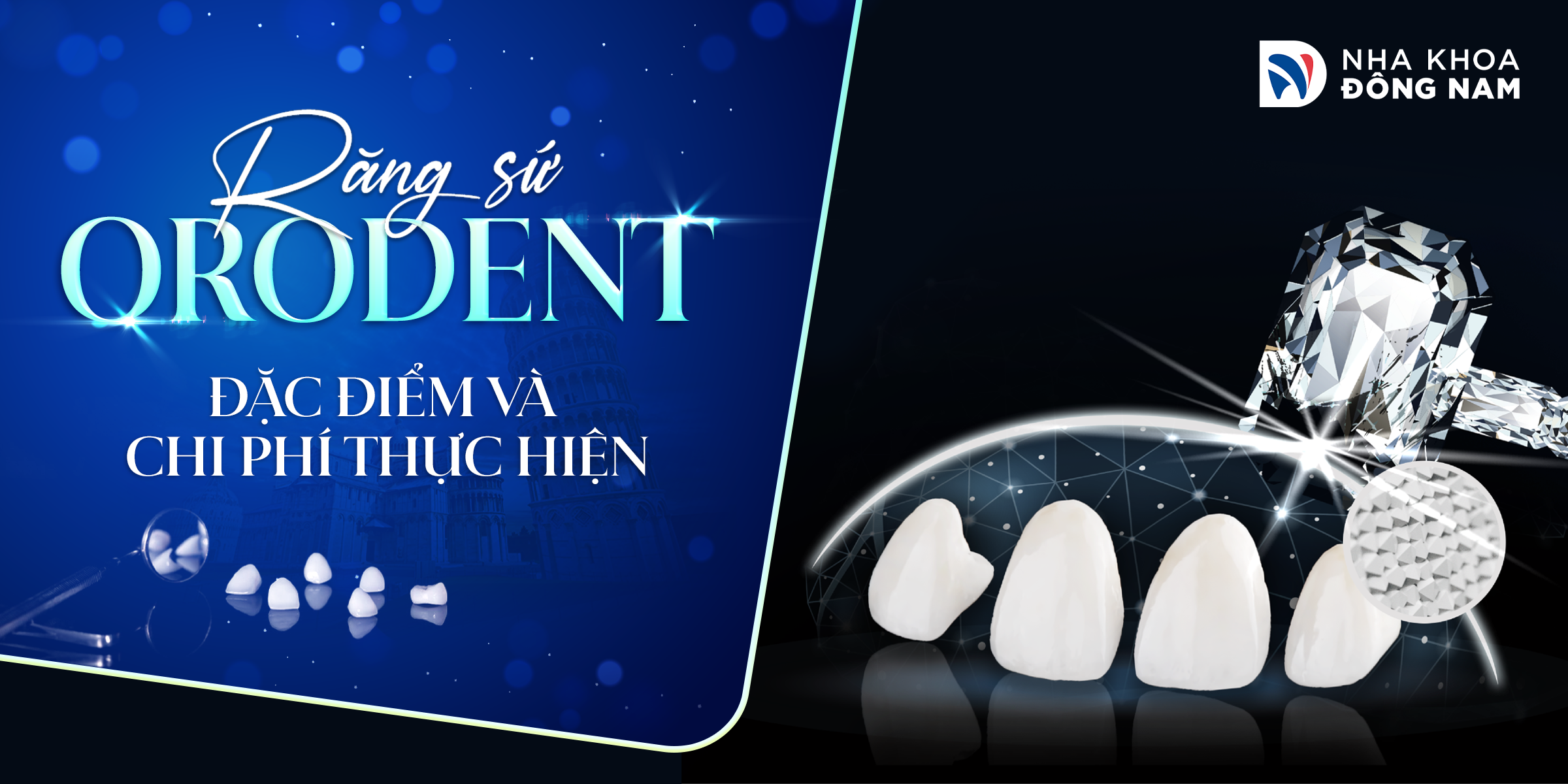 Răng sứ Orodent cao cấp